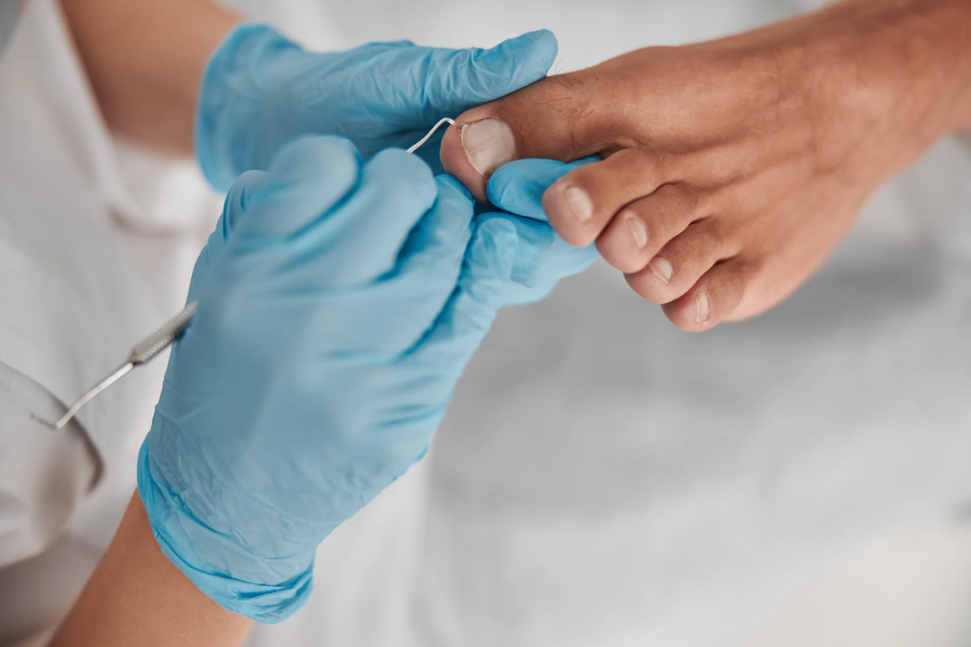 Toenail Surgery