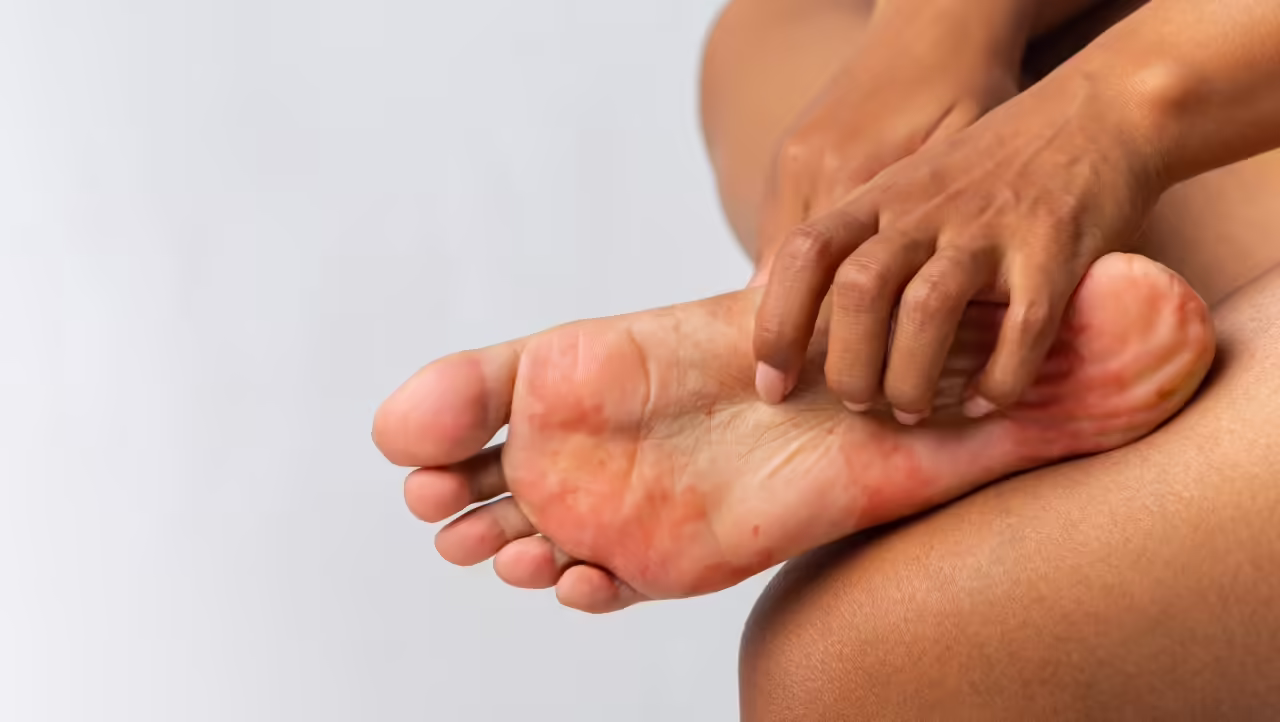 itchy foot being scratched on plain background 2026 03 24 02 21 21 utc